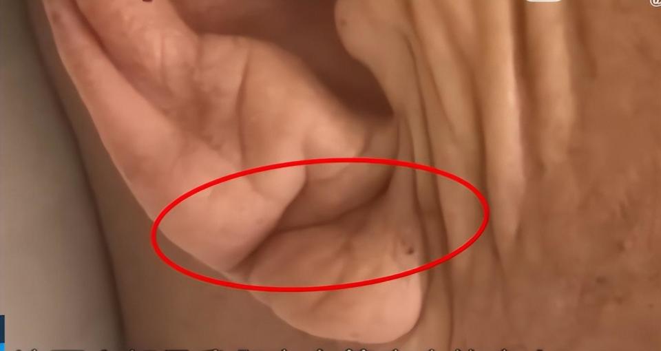  【深度科普】心血管隐匿风险排查与临床体征识别指南 健康养生